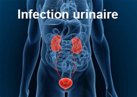 sodomie et infection urinaire|Pourquoi jai une infection urinaire après chaque rapport sexuel